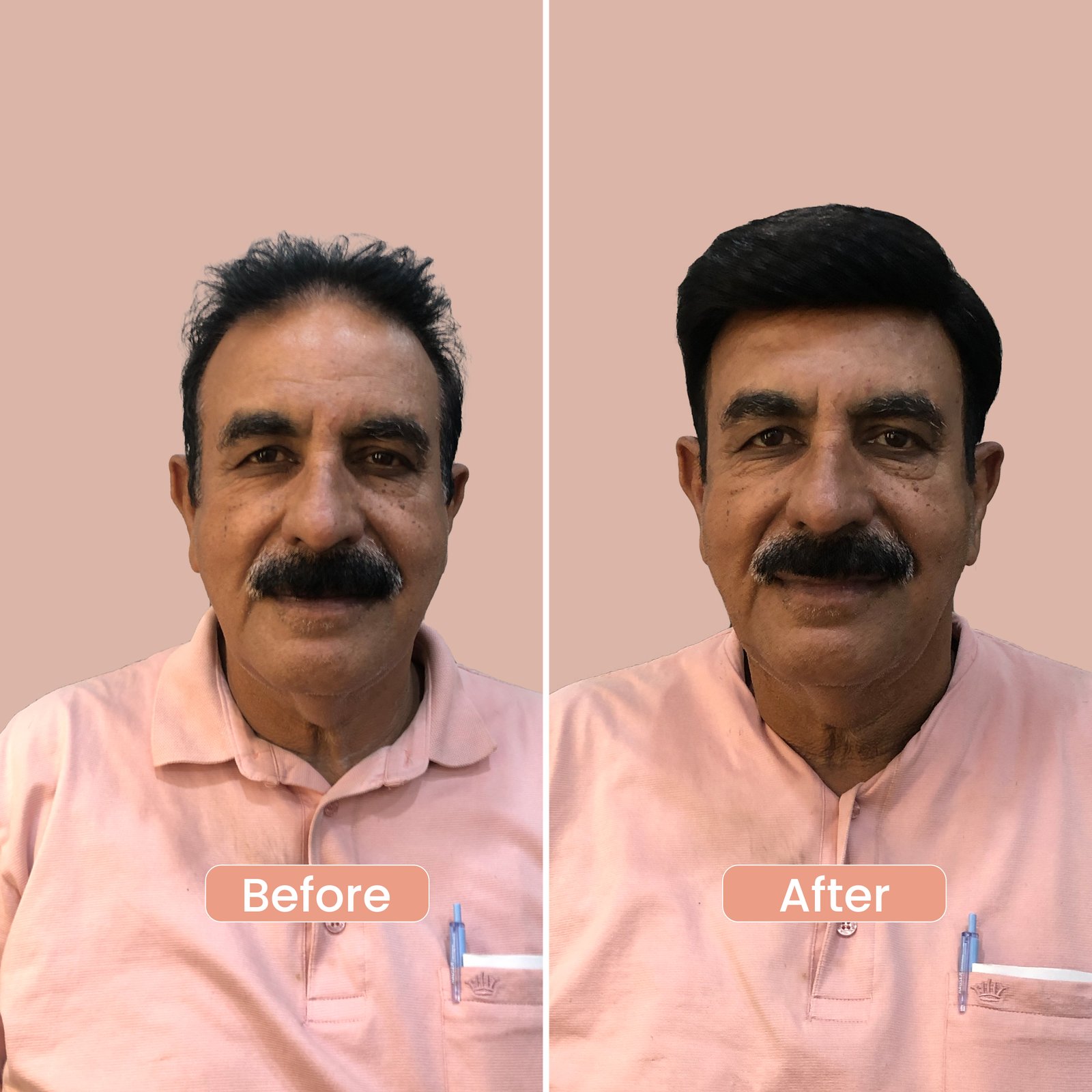 Premium natural wigs and hair patches in Rohini